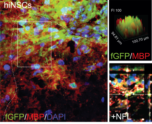 Confocal microscopy image highlighting the repair of nerve insulation (myelin) in spinal cord lesions after stem cell treatment. 