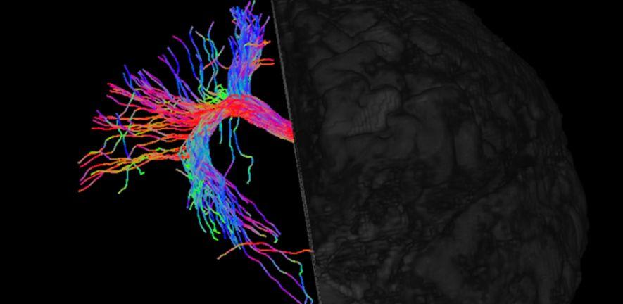 MRI image