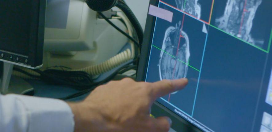 NHS clinician looking at scan