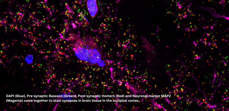 tissue in the occipital cortex